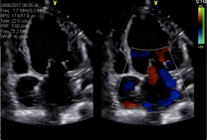 Diagnostik Kardiologie Darmstadt